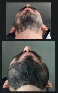 محلول تخصصی رشد.۲۴روزهه