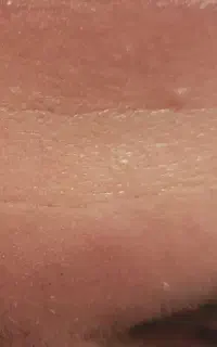 خدمات زیبایی بوتاکس و فیلرو جوانسازی