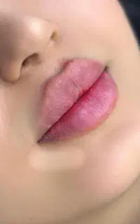 تزریق فیلر و بوتاکس و خدمات پیرسینگ صورت