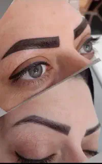 بمب تخفیف میکروبلیدینگ و تتو صورت