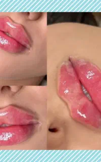 لب روسی،فیلرچشم،بوتاکس‌چشم‌گربه،تخفیف ویژه تابستان