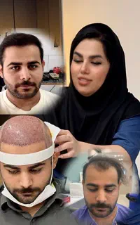 پرتراکم‌ترین کاشت مو(خانم بهروزی) ، نقد و اقساط