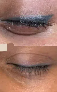 ریمو خط چشم با کمترین هزینه