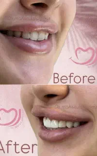 دندانپزشکی  دکتر جعفرپور با شرایط ویژه