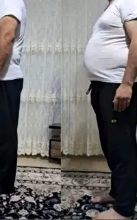 لاغری تضمینی، چربی سوزی، امبدینگ