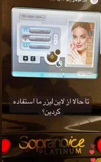 لیزر ونوس با دستگاه Soprano ICE Platinum