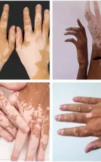 بپا جا نمونی از بقیه