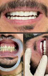 دندانپزشکی.ارتودنسی.عصبکشی.کامپوزیت.روکش