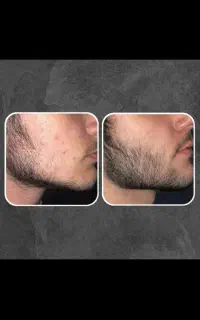 نتیجه فوق‌العاده‌ تضمینی