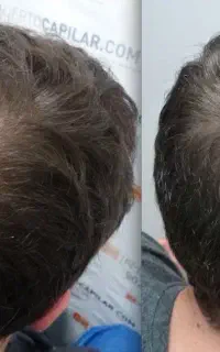 دیگه نیازی نیست بری مو بکاری