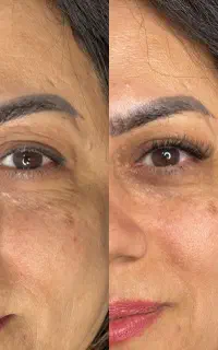 اکستنشن مژه
