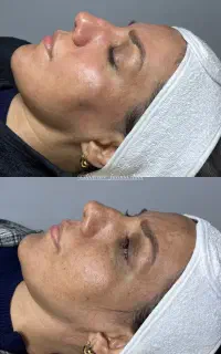فیشال تخصصی