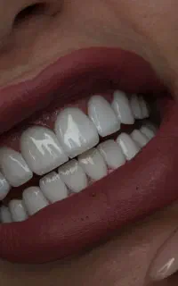 دندانپزشکی و ایمپلنت با شرایط اقساطی