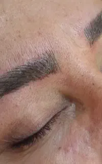 میکروبلیدینگ