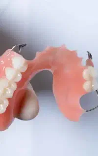 دندان مصنوعی بهترین جایگزین ایمپلنت