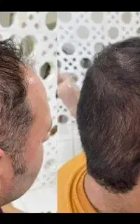 کاشت ممنوع
