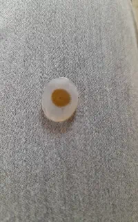 سنگ شجر