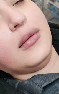 مرکز لیزر آیسل زرین شهر