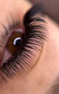 کاشت مژه