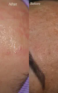 آموزش فشیال
