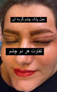 بهترین جشنواره سال در کیلنیک آرییل با تیم پزشکی