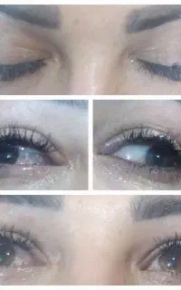 کاشت مژه با دوام