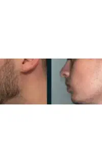 پکیج ریش و سیبیل کاملا گیاهی