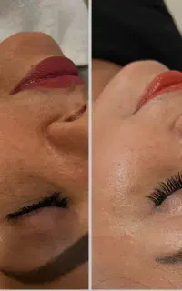 پاکسازی و فیشیال تخصصی