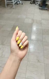 کاشت ناخن