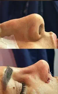 تمامی  لاینهای زیبایی  .عمل  بینی در بیمارستان