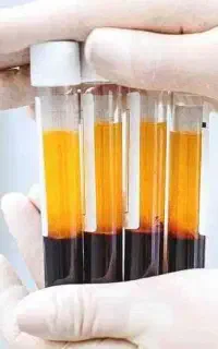 تخفیفات پی ار پیPRP مو و صورت