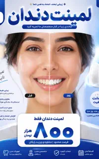 Fz بال تونFJzf