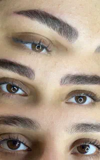 تتوصورت میکروخطچشم شیدینگ ژل بوتاکس