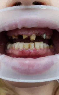 لابراتوار دندانپزشکی (سازنده انواع روکش 2500ت)