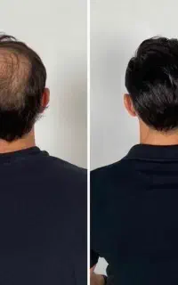 به قرآن راهش اینه