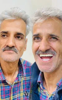 دندانسازی دکتر انصاری (دندانسازی شهر محلات)