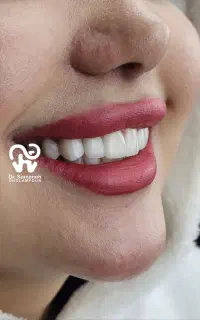 مطب دندانپزشکی طرف قرارداد با بیمه های تکمیلی