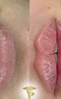 تخفیف بهاری در مطب دکترفلاحت کار