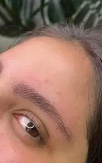 آموزش و خدمات میکروبلیدینگ فیبروز ابرو