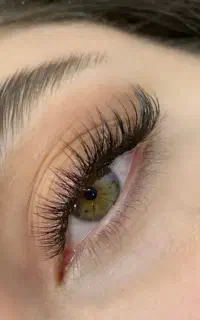 کاشت و اکسیشن مژه