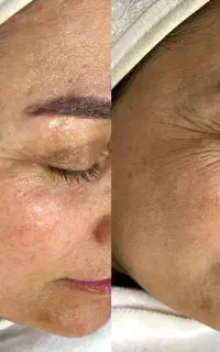 پاکسازی درمانی و جوانسازی