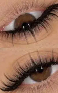 کاشت مژه هیدن