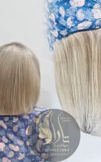 کلیه خدمات اریشی باتخفیف ویژه