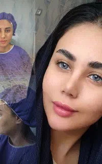 جراحی زیبایی بینی/مراجعه از فارسان به تهران/۴۳تومن
