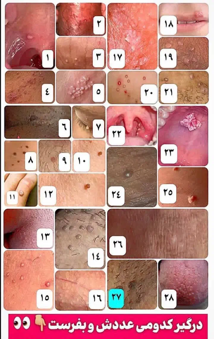 برای همیشه راحت شو|خدمات آرایشگری و زیبایی|کجور, |دیوار