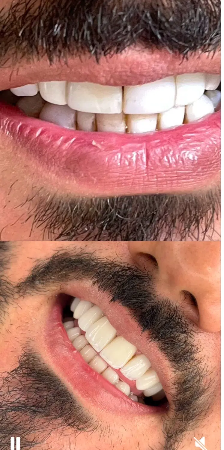 خدمات دندانپزشکی با اقساط بدون پیش پرداخت|خدمات زیبایی و سلامت|تهران, تهرانپارس غربی|دیوار