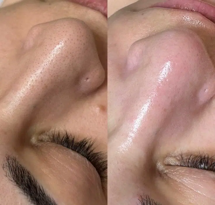 پوست شفاف پاکسازی رفع لک|خدمات آرایشگری و زیبایی|کرمانشاه, |دیوار