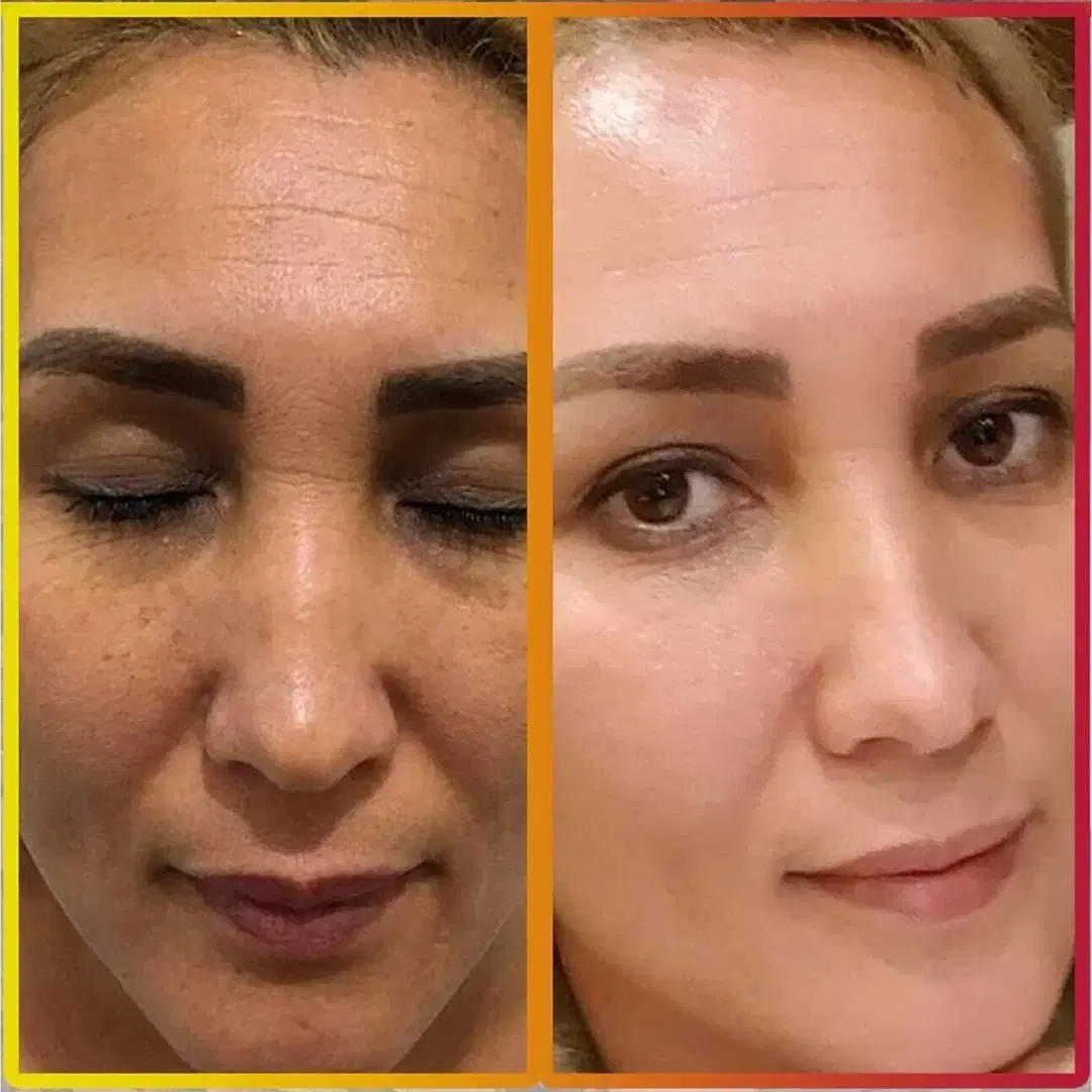 صورت|خدمات زیبایی و سلامت|دلند, |دیوار