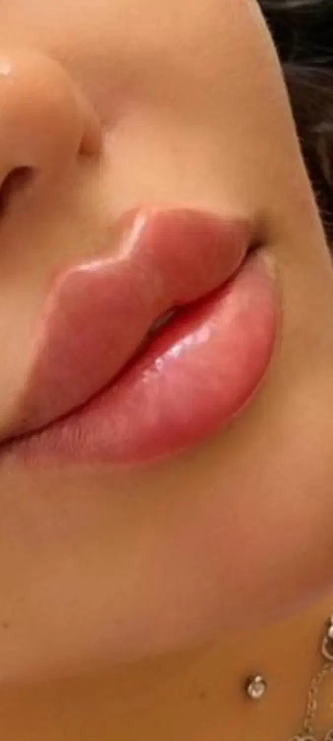 خدمات بوتاکس و ژل و تمام کارهای زیبایی|خدمات آرایشگری و زیبایی|تهران, یاخجی آباد|دیوار