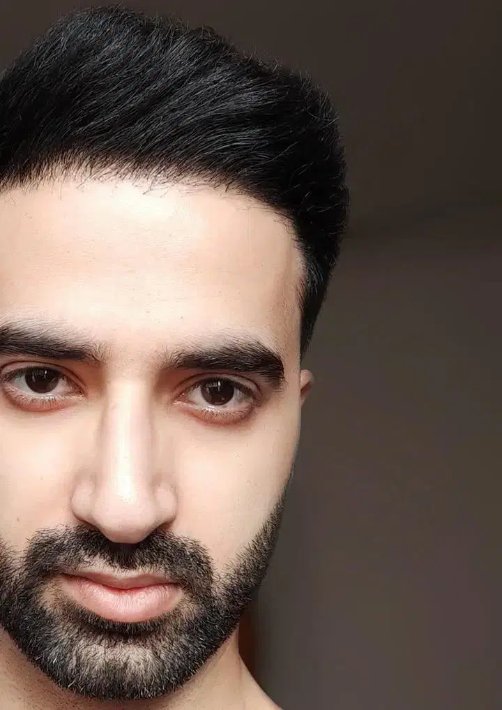 کاشت مو بوتاکس فیلر جهرم